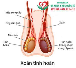 Xoắn tinh hoàn là gì?