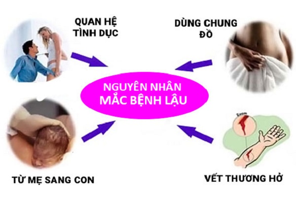 Bệnh lậu mãn tính có thể lây qua những đường nào?