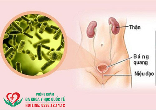 Viêm đường tiết niệu tiểu ra máu có nguy hiểm hay không?