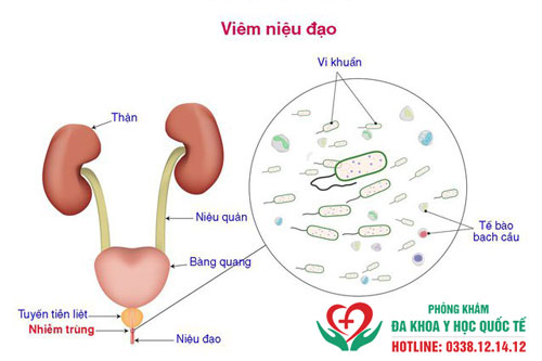 Điều hòa kinh nguyệt không đều bằng thuốc tránh thai 