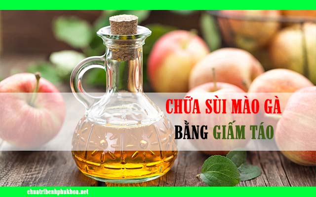 Dùng dấm táo chữa sùi mào gà