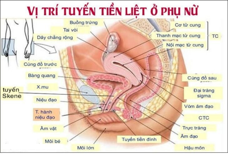 Viêm tuyến tiền liệt ở nữ giới như nào?