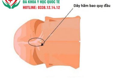 Rách dây hãm bao quy đầu có nguy hiểm không