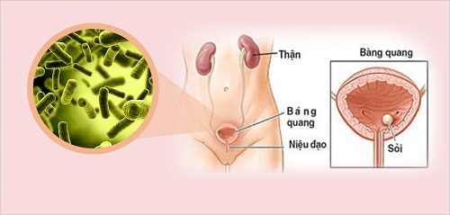 Dương vật nổi mụn trắng không ngứa có sao không?