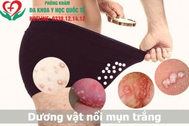 Dương vật nổi mụn trắng không ngứa có sao không?