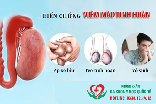 Viêm mào tinh hoàn nó tự khỏi được không?