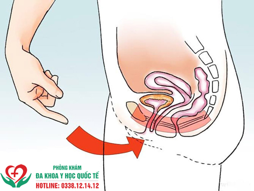 Tình trạng xuất tinh ngược là gì?