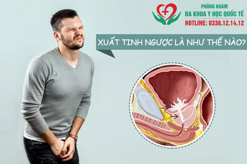 Tình trạng xuất tinh ngược là gì?