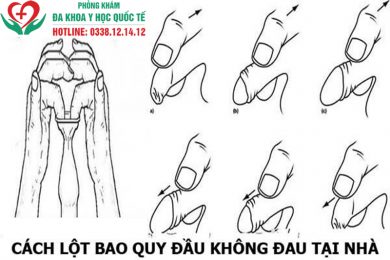 Tự lột bao quy đầu tại nhà không đau và an toàn