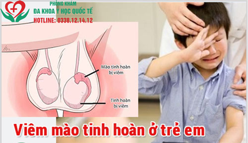 Viêm mào tinh hoàn ở trẻ em có nguy hiểm không?