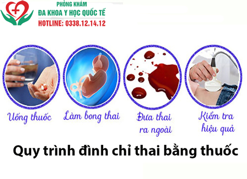 Đình chỉ thai 4 tuần có được không?