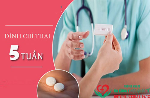 Đình chỉ thai 5 tuần có được không?