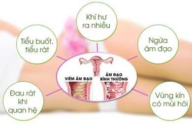 Bệnh phụ khoa và cách phòng tránh hiệu quả 