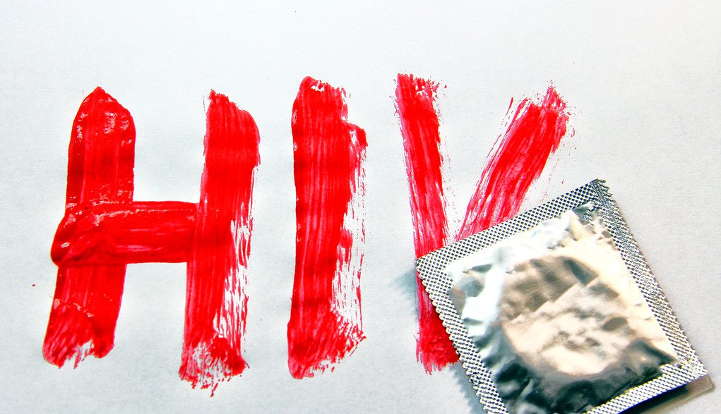 Bệnh HIV/AIDS lây qua đường tình dục như thế nào?